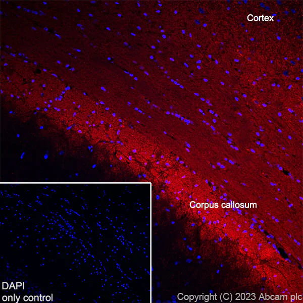 Immunohistochemistry (Frozen sections) - Alexa Fluor® 555 Anti-Myelin Basic Protein antibody [EPR21188] (AB315358)