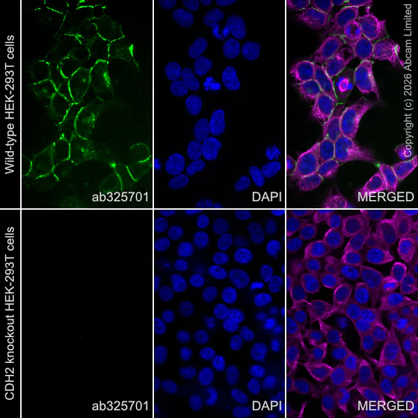 Immunocytochemistry/ Immunofluorescence - Alexa Fluor® 555 Anti-N Cadherin antibody [EPR29626-10] (AB325701)