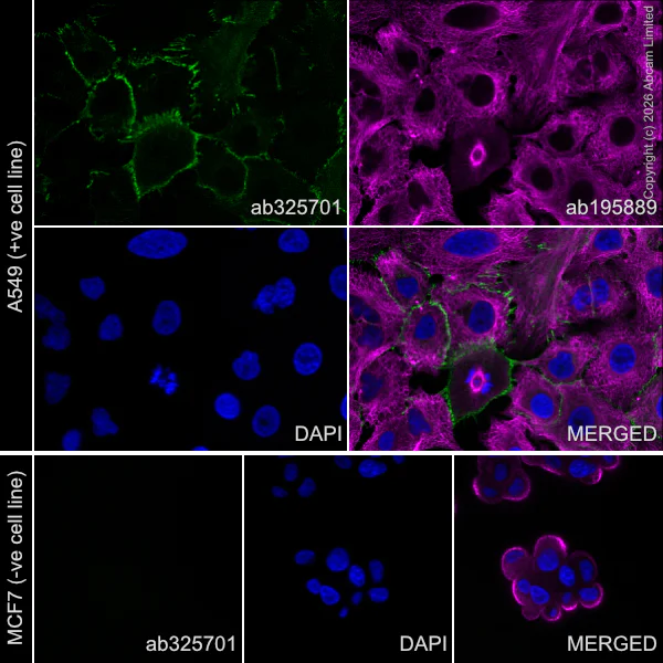 Immunocytochemistry/ Immunofluorescence - Alexa Fluor® 555 Anti-N Cadherin antibody [EPR29626-10] (AB325701)
