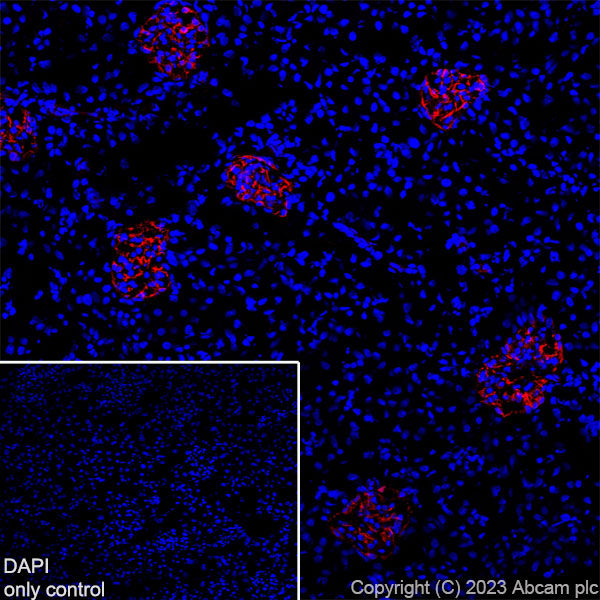Immunohistochemistry (Frozen sections) - Alexa Fluor® 555 Anti-Nestin antibody [EPR22023] (AB313823), expandable thumbnail