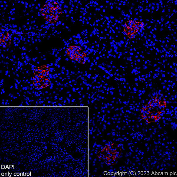 Immunohistochemistry (Frozen sections) - Alexa Fluor® 555 Anti-Nestin antibody [EPR22023] - Neural Stem Cell Marker (AB313823)