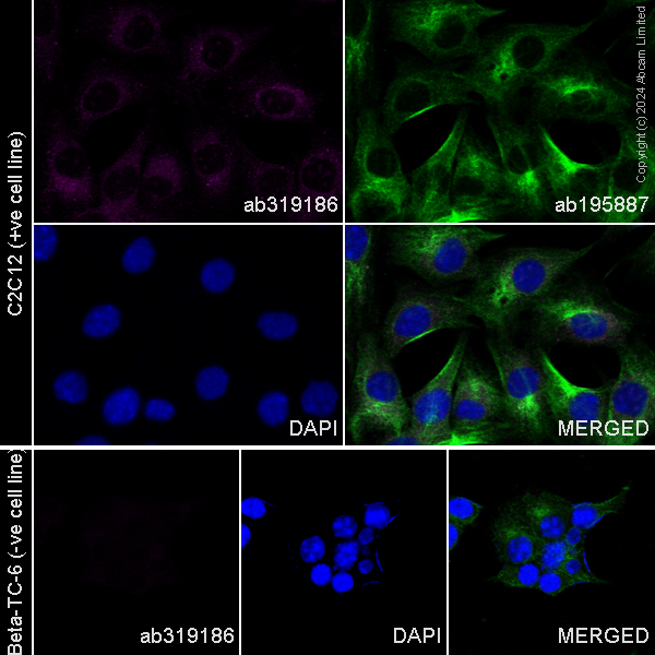 Immunocytochemistry/ Immunofluorescence - Alexa Fluor® 555 Anti-Nestin antibody [EPR27207-53] (AB319186), expandable thumbnail