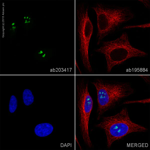 Immunocytochemistry/ Immunofluorescence - Alexa Fluor® 555 Anti-Nucleolin antibody [EPR7952] (AB203417)