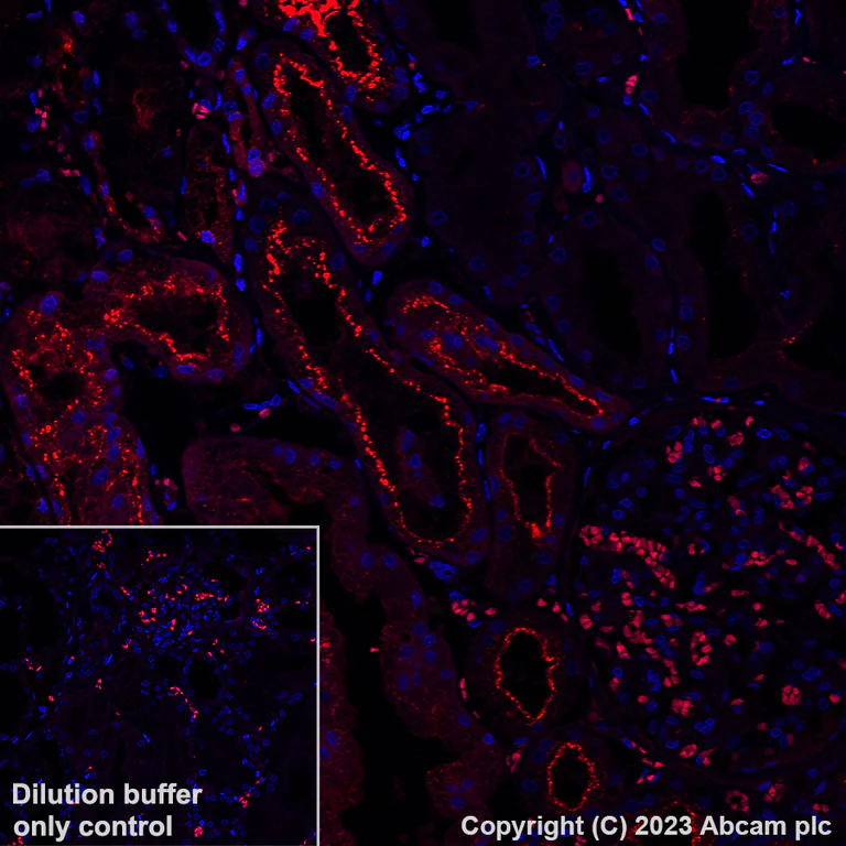 Immunohistochemistry (Formalin/PFA-fixed paraffin-embedded sections) - Alexa Fluor® 555 Anti-Osteopontin antibody [EPR21139-316] (AB309603)