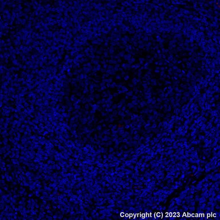 Immunohistochemistry (Formalin/PFA-fixed paraffin-embedded sections) - Alexa Fluor® 555 Anti-Osteopontin antibody [EPR21139-316] (AB309603)