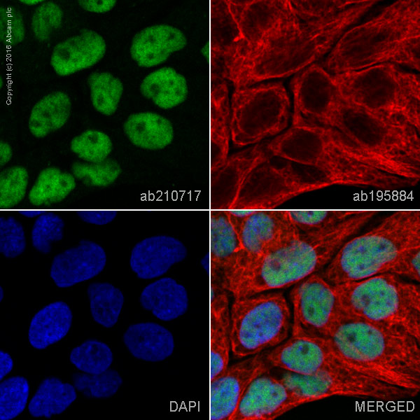 Immunocytochemistry/ Immunofluorescence - Alexa Fluor® 555 Anti-p53 antibody [E47] (AB210717)