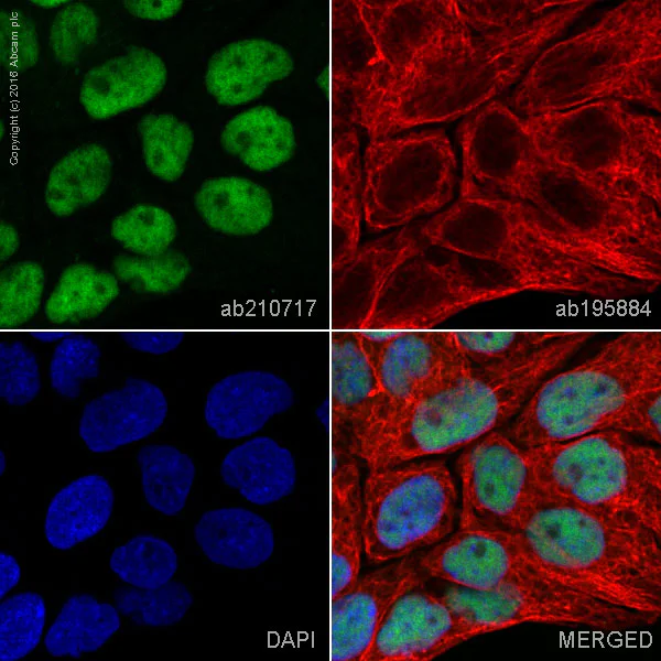 Immunocytochemistry/ Immunofluorescence - Alexa Fluor® 555 Anti-p53 antibody [E47] (AB210717)