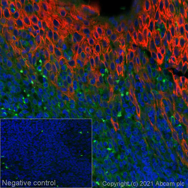 Immunohistochemistry (Formalin/PFA-fixed paraffin-embedded sections) - Alexa Fluor® 555 Anti-pan Cytokeratin antibody [C-11] (AB279324)