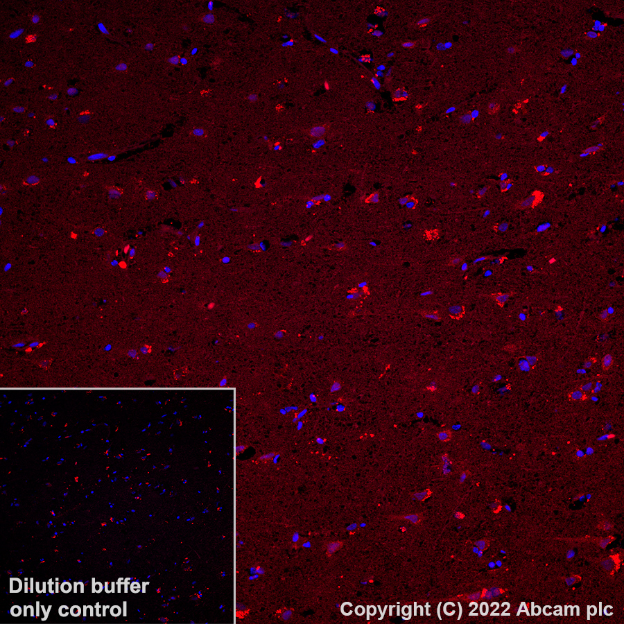 Immunohistochemistry (Formalin/PFA-fixed paraffin-embedded sections) - Alexa Fluor® 555 Anti-PARK7/DJ1 antibody [EP2815Y] (AB307128), expandable thumbnail