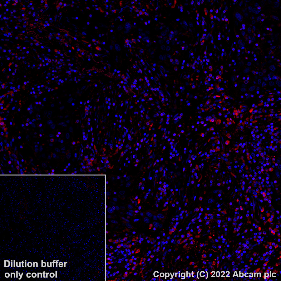 Immunohistochemistry (Formalin/PFA-fixed paraffin-embedded sections) - Alexa Fluor® 555 Anti-PARK7/DJ1 antibody [EP2815Y] (AB307128), expandable thumbnail