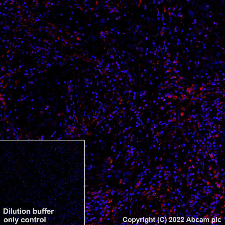 Immunohistochemistry (Formalin/PFA-fixed paraffin-embedded sections) - Alexa Fluor® 555 Anti-PARK7/DJ1 antibody [EP2815Y] (AB307128)