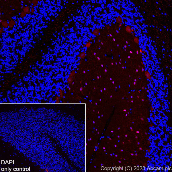 Immunohistochemistry (Frozen sections) - Alexa Fluor® 555 Anti-Parvalbumin antibody [EPR13091] (AB313815)