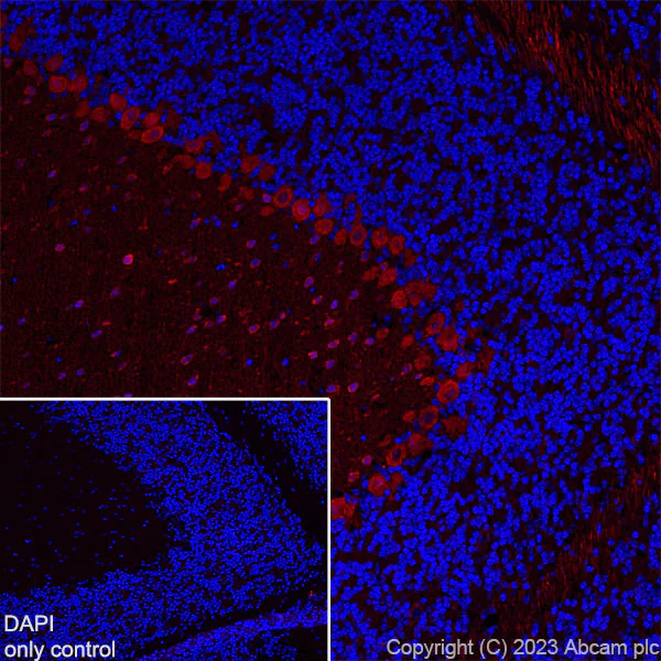 Immunohistochemistry (Frozen sections) - Alexa Fluor® 555 Anti-Parvalbumin antibody [EPR13091] (AB313815)