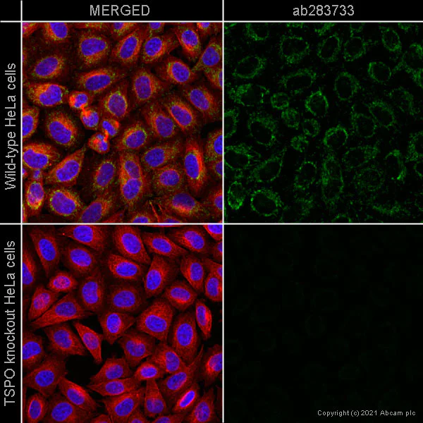 Immunocytochemistry/ Immunofluorescence - Alexa Fluor® 555 Anti-PBR antibody [EPR5384] (AB283733)