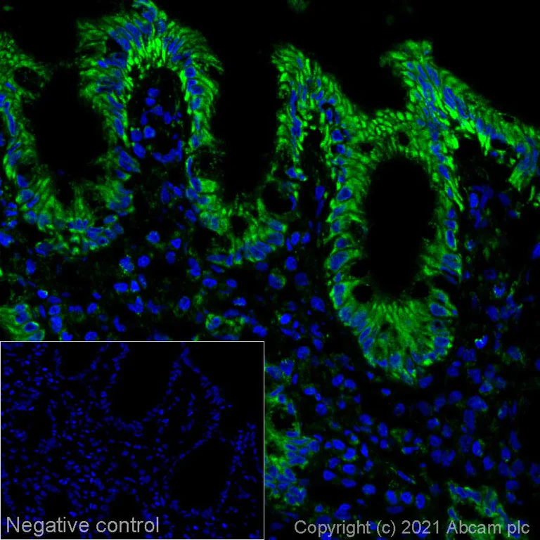 Immunohistochemistry (Frozen sections) - Alexa Fluor® 555 Anti-PBR antibody [EPR5384] (AB283733)