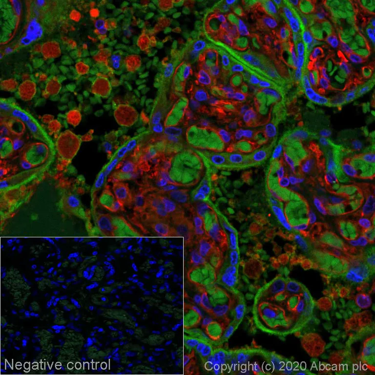 Immunohistochemistry (Formalin/PFA-fixed paraffin-embedded sections) - Alexa Fluor® 555 Anti-PD-L1 antibody [73-10] (AB274896)