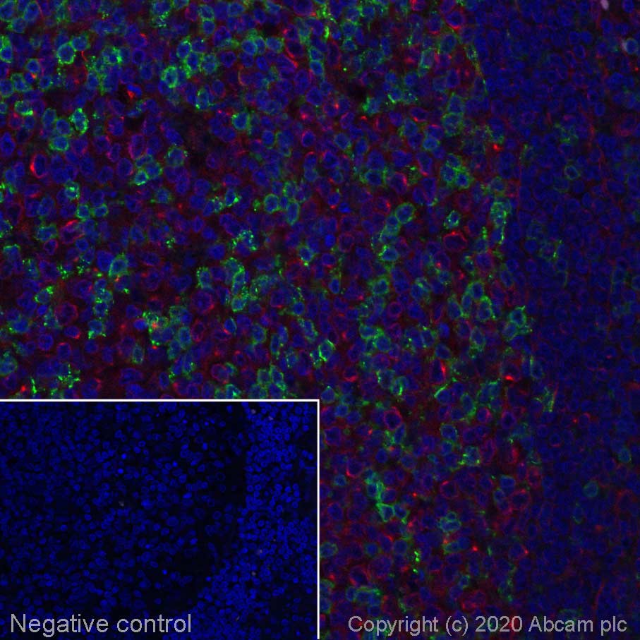 Immunohistochemistry (Formalin/PFA-fixed paraffin-embedded sections) - Alexa Fluor® 555 Anti-PD1 antibody [EPR4877(2)] (AB275126), expandable thumbnail