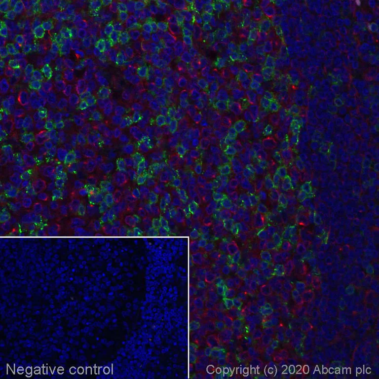 Immunohistochemistry (Formalin/PFA-fixed paraffin-embedded sections) - Alexa Fluor® 555 Anti-PD1 antibody [EPR4877(2)] (AB275126)