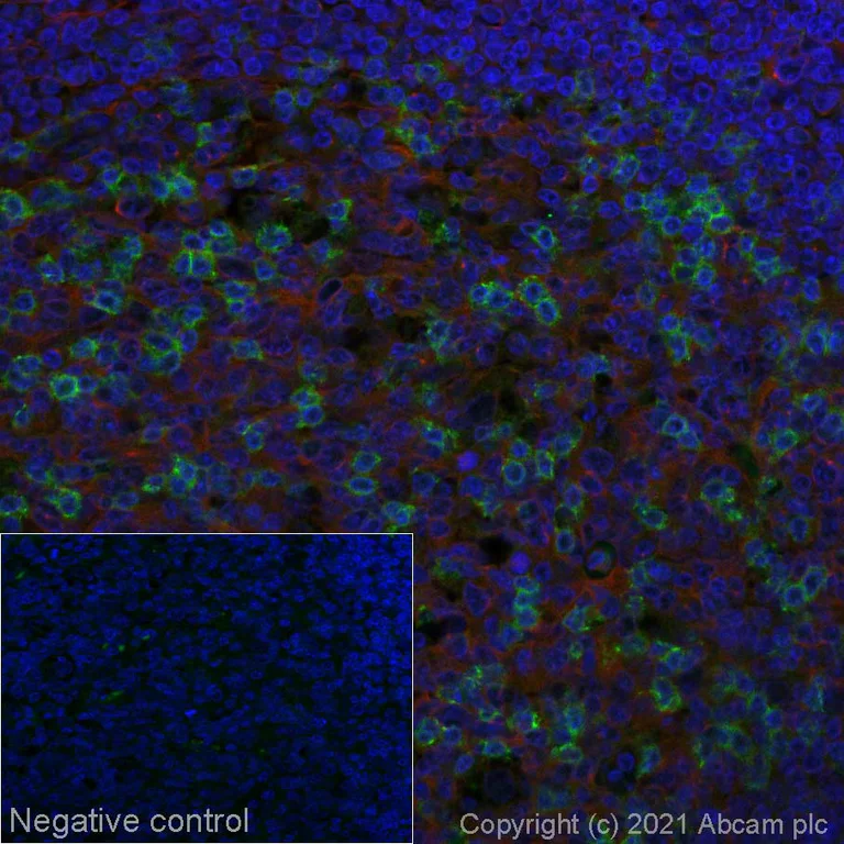 Immunohistochemistry (Formalin/PFA-fixed paraffin-embedded sections) - Alexa Fluor® 555 Anti-PD1 antibody [NAT105] (AB280864)