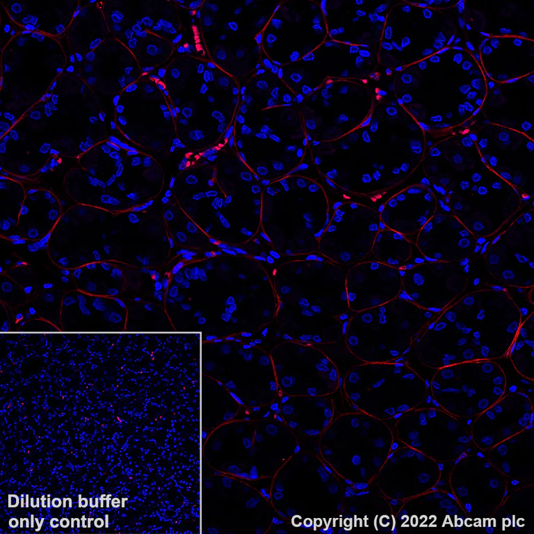 Immunohistochemistry (Formalin/PFA-fixed paraffin-embedded sections) - Alexa Fluor® 555 Anti-Periostin antibody [EPR20806] (AB307126)