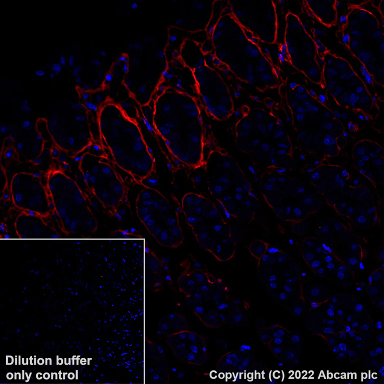 Immunohistochemistry (Formalin/PFA-fixed paraffin-embedded sections) - Alexa Fluor® 555 Anti-Periostin antibody [EPR20806] (AB307126)