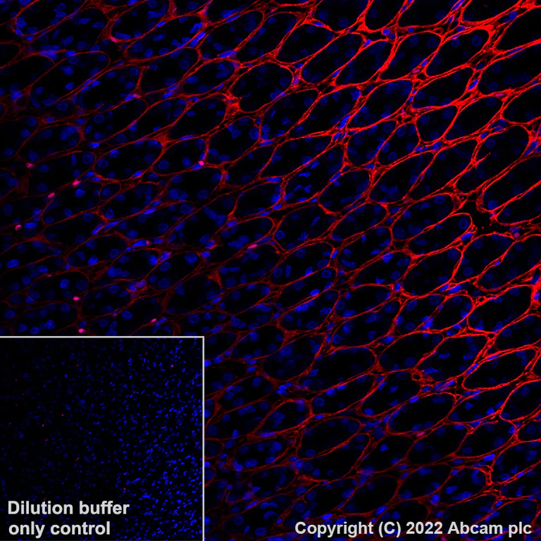 Immunohistochemistry (Formalin/PFA-fixed paraffin-embedded sections) - Alexa Fluor® 555 Anti-Periostin antibody [EPR20806] (AB307126)