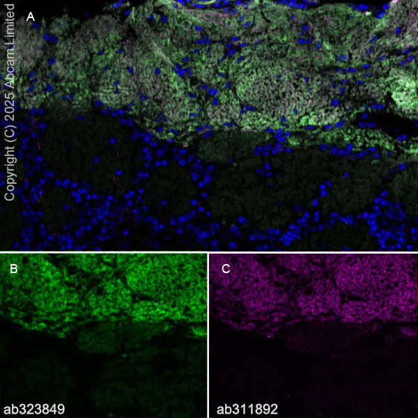 Immunohistochemistry (Frozen sections) - Alexa Fluor® 555 Anti-Peripherin antibody [EPR23445-28] (AB311892)