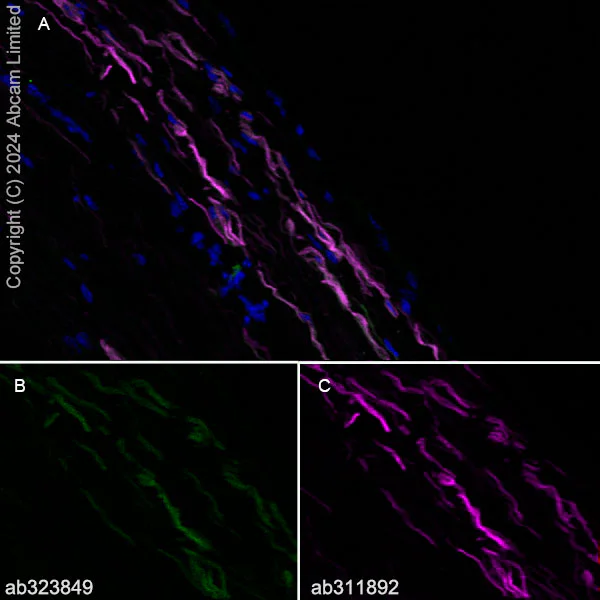 Immunohistochemistry (Frozen sections) - Alexa Fluor® 555 Anti-Peripherin antibody [EPR23445-28] (AB311892)