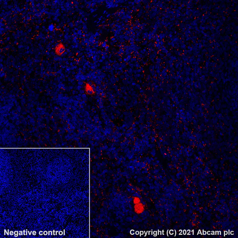 Immunohistochemistry (Formalin/PFA-fixed paraffin-embedded sections) - Alexa Fluor® 555 Anti-PF4 antibody [EPR7763] (AB282111)