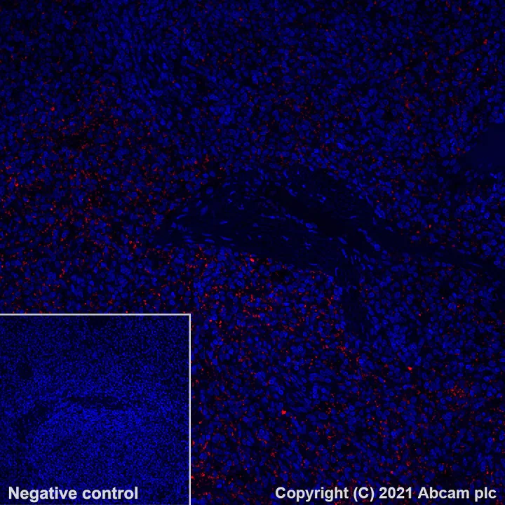 Immunohistochemistry (Formalin/PFA-fixed paraffin-embedded sections) - Alexa Fluor® 555 Anti-PF4 antibody [EPR7763] (AB282111)