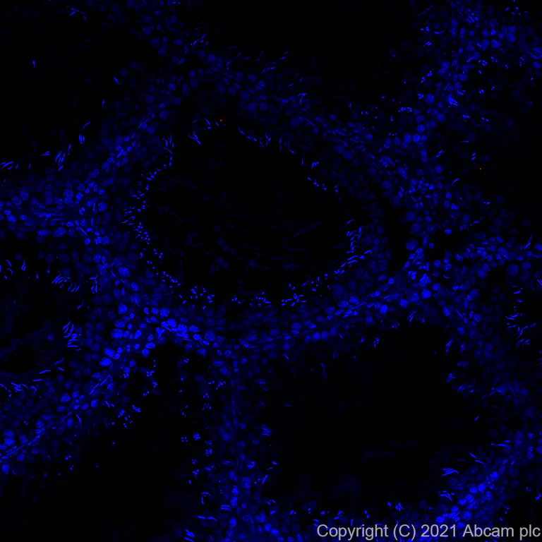 Immunohistochemistry (Formalin/PFA-fixed paraffin-embedded sections) - Alexa Fluor® 555 Anti-PF4 antibody [EPR7763] (AB282111)