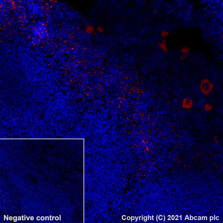 Immunohistochemistry (Formalin/PFA-fixed paraffin-embedded sections) - Alexa Fluor® 555 Anti-PF4 antibody [EPR7763] (AB282111)