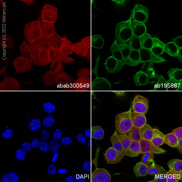 Immunocytochemistry/ Immunofluorescence - Alexa Fluor® 555 Anti-PGP9.5 antibody [EPR4118] - Neuronal Marker (AB300549)