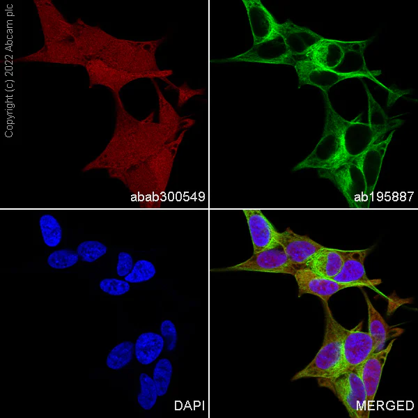 Immunocytochemistry/ Immunofluorescence - Alexa Fluor® 555 Anti-PGP9.5 antibody [EPR4118] - Neuronal Marker (AB300549)