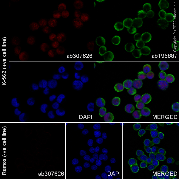 Immunocytochemistry/ Immunofluorescence - Alexa Fluor® 555 Anti-PRAME antibody [EPR20330] (AB307626), expandable thumbnail