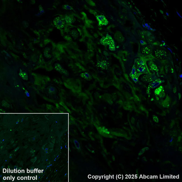 Immunohistochemistry (Formalin/PFA-fixed paraffin-embedded sections) - Alexa Fluor® 555 Anti-PRG2 antibody [EPR29096-502] (AB324901)