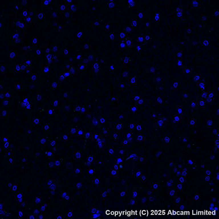 Immunohistochemistry (Formalin/PFA-fixed paraffin-embedded sections) - Alexa Fluor® 555 Anti-PRG2 antibody [EPR29096-502] (AB324901)
