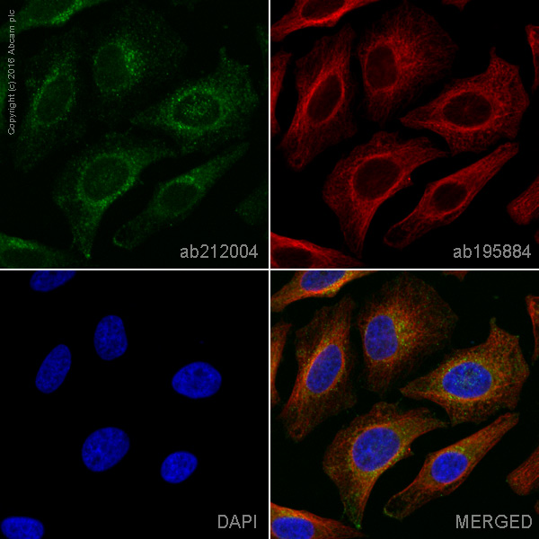 Immunocytochemistry/ Immunofluorescence - Alexa Fluor® 555 Anti-RAB8A antibody [EPR14873] - C-terminal (AB212004)