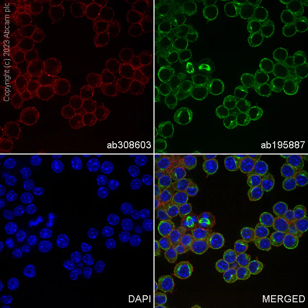 Immunocytochemistry/ Immunofluorescence - Alexa Fluor® 555 Anti-Ras antibody [EP1125Y] (AB308603)