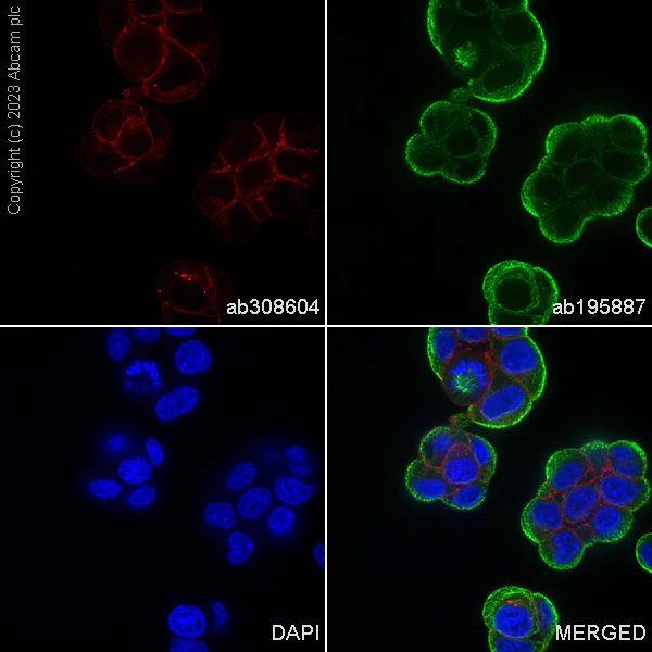 Immunocytochemistry/ Immunofluorescence - Alexa Fluor® 555 Anti-Ras antibody [EPR3255] (AB308604)
