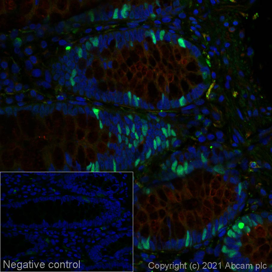 Immunohistochemistry (Formalin/PFA-fixed paraffin-embedded sections) - Alexa Fluor® 555 Anti-Rb (phospho S807) antibody [EPR17732] (AB280855), expandable thumbnail