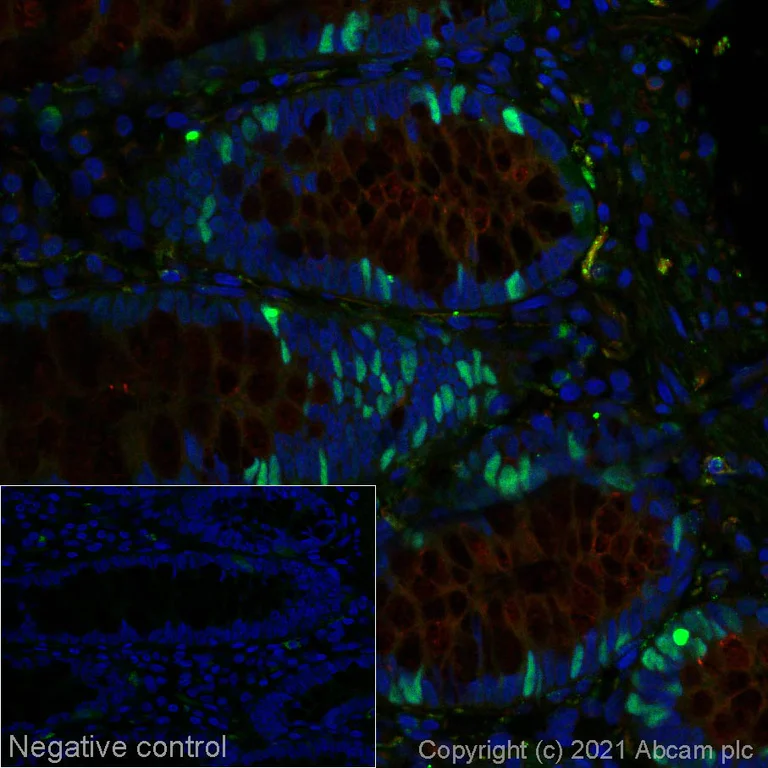 Immunohistochemistry (Formalin/PFA-fixed paraffin-embedded sections) - Alexa Fluor® 555 Anti-Rb (phospho S807) antibody [EPR17732] (AB280855)