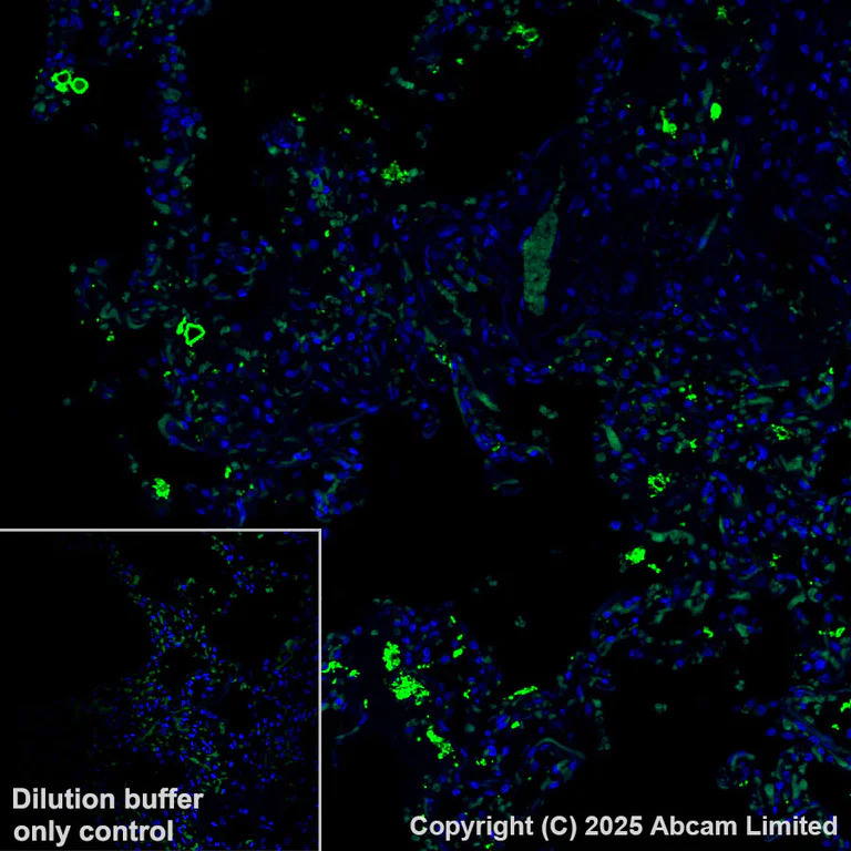 Immunohistochemistry (Formalin/PFA-fixed paraffin-embedded sections) - Alexa Fluor® 555 Anti-SFTPA1 + SFTPA2 antibody [EPR29098-6] (AB324339)