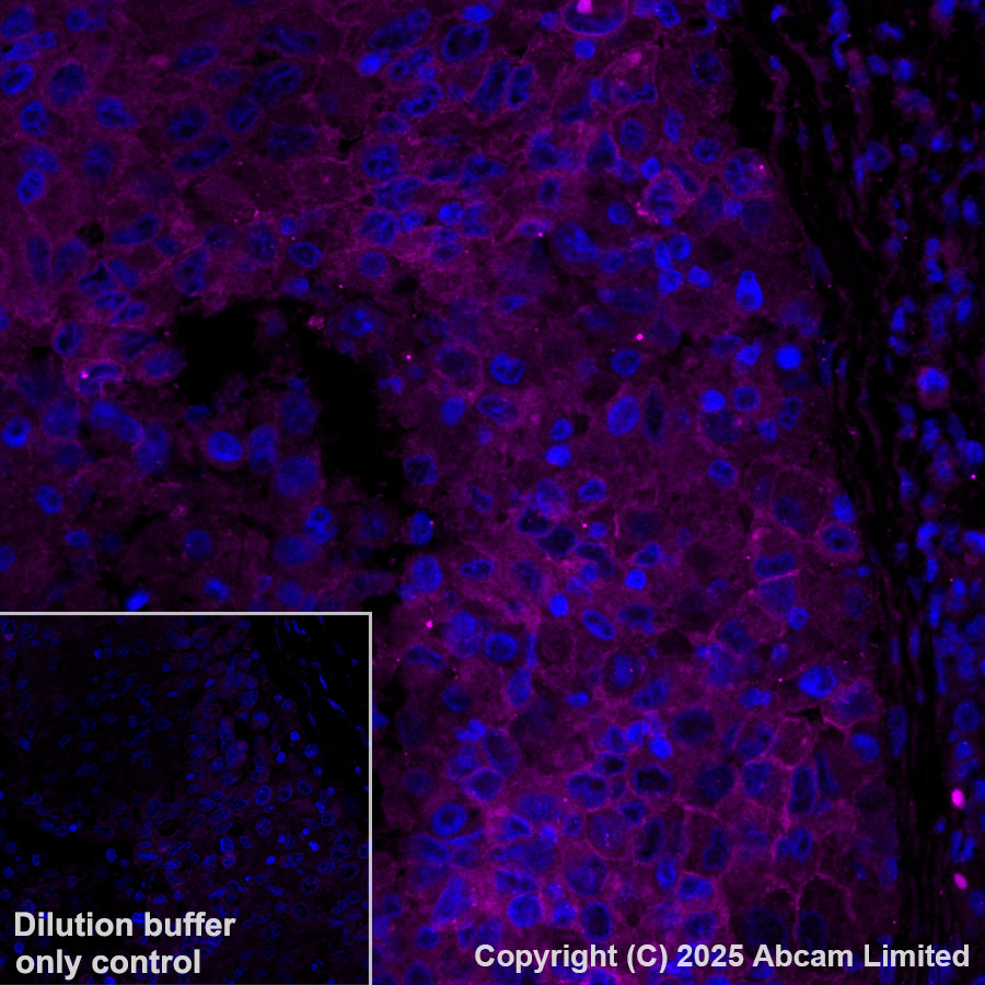 Immunohistochemistry (Formalin/PFA-fixed paraffin-embedded sections) - Alexa Fluor® 555 Anti-SLC16A3/MCT 4 antibody [EPR28177-30] (AB323437), expandable thumbnail