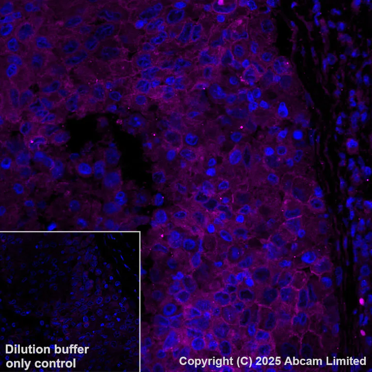 Immunohistochemistry (Formalin/PFA-fixed paraffin-embedded sections) - Alexa Fluor® 555 Anti-SLC16A3/MCT 4 antibody [EPR28177-30] (AB323437)