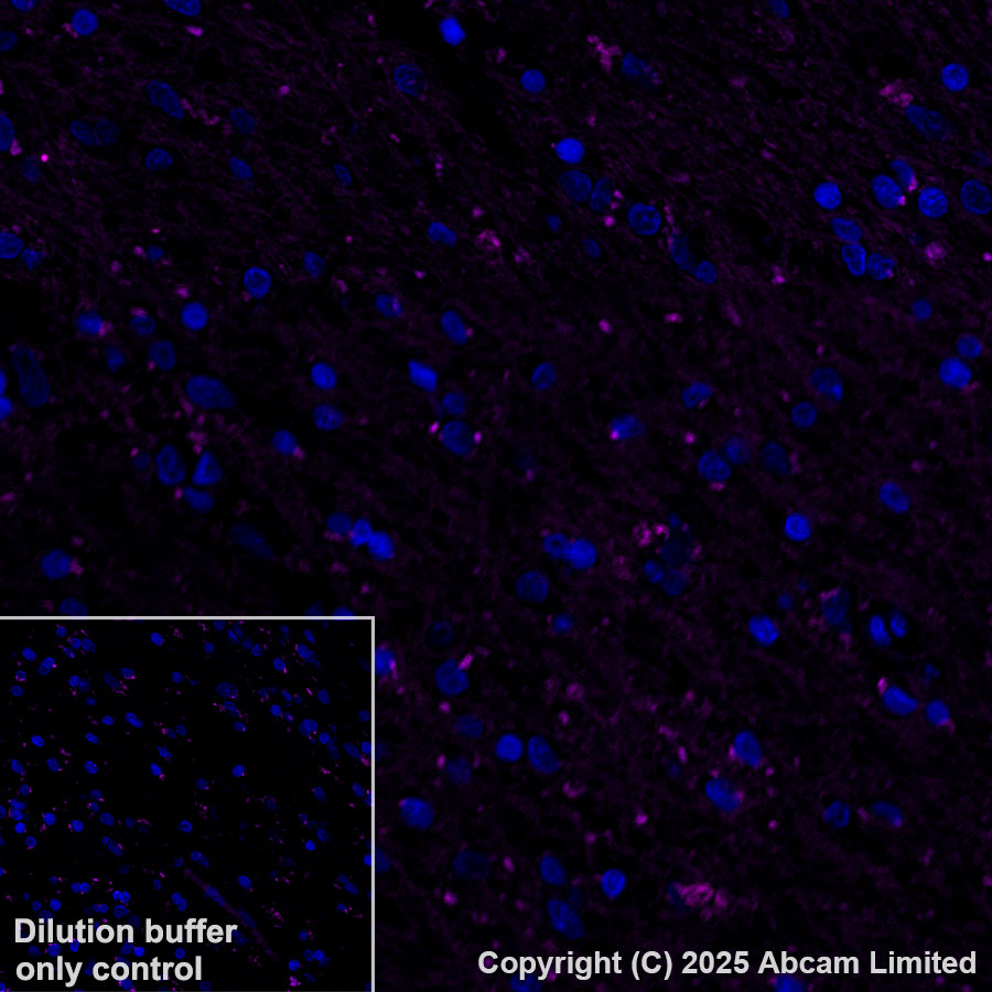 Immunohistochemistry (Formalin/PFA-fixed paraffin-embedded sections) - Alexa Fluor® 555 Anti-SLC16A3/MCT 4 antibody [EPR28177-30] (AB323437), expandable thumbnail