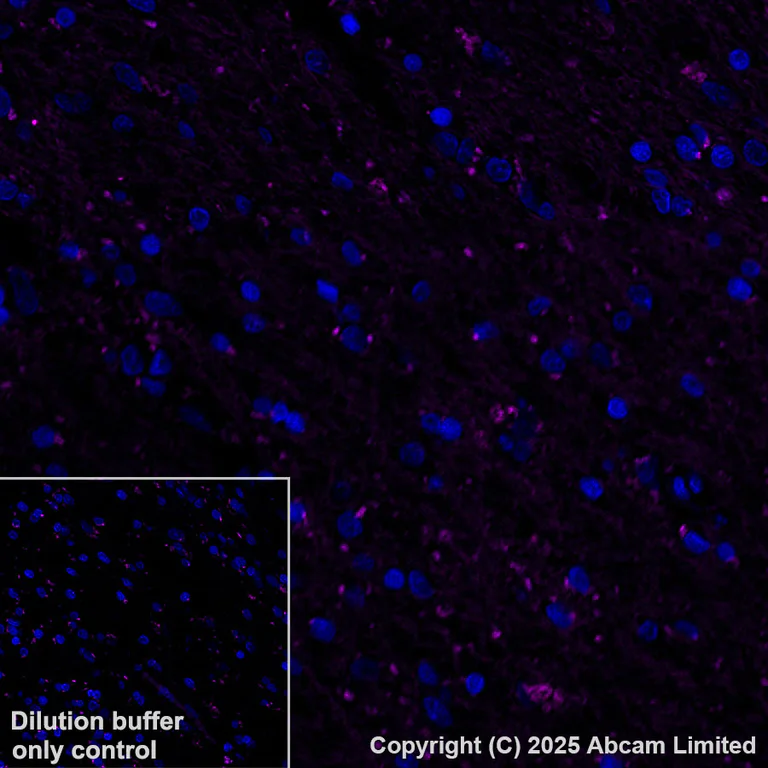 Immunohistochemistry (Formalin/PFA-fixed paraffin-embedded sections) - Alexa Fluor® 555 Anti-SLC16A3/MCT 4 antibody [EPR28177-30] (AB323437)