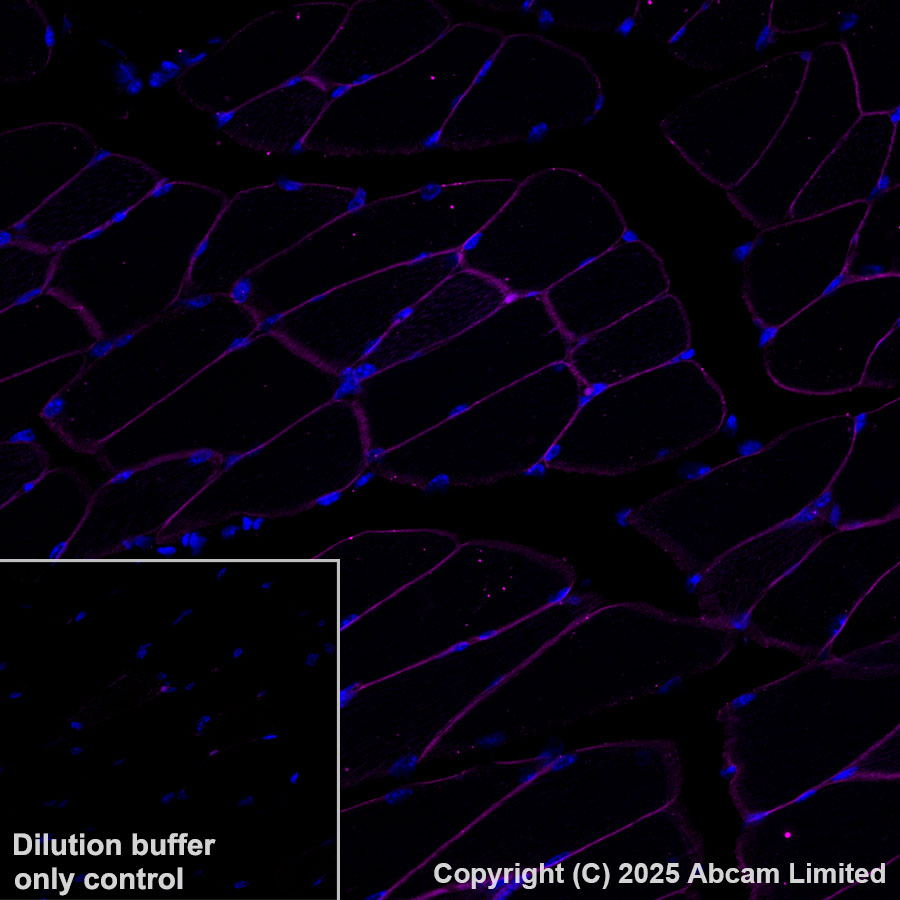 Immunohistochemistry (Formalin/PFA-fixed paraffin-embedded sections) - Alexa Fluor® 555 Anti-SLC16A3/MCT 4 antibody [EPR28177-30] (AB323437), expandable thumbnail