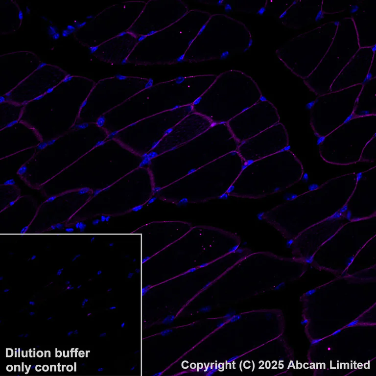 Immunohistochemistry (Formalin/PFA-fixed paraffin-embedded sections) - Alexa Fluor® 555 Anti-SLC16A3/MCT 4 antibody [EPR28177-30] (AB323437)