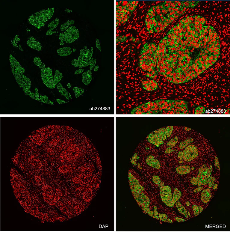 Multiplex immunohistochemistry - Alexa Fluor® 555 Anti-Sodium Potassium ATPase antibody [EP1845Y] - Plasma Membrane Marker (AB274883)